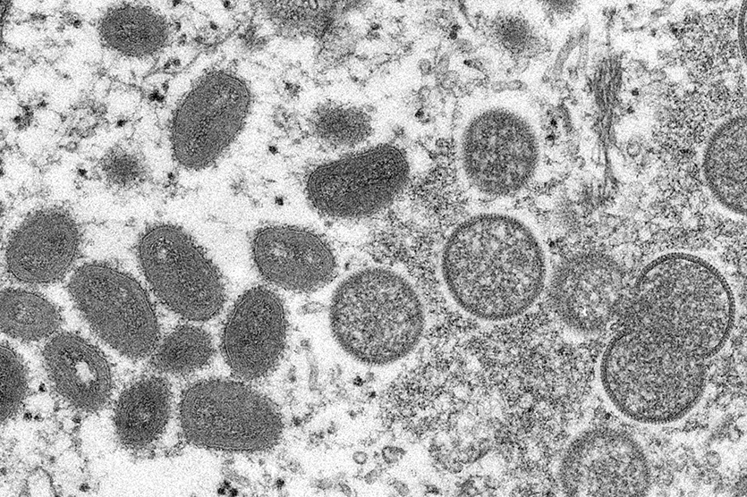 진스랩이 70분만에 ‘원숭이두창’ 감염 여부를 확인 할 수 있는 진단키트를 개발했다. 미국 질병통제예방센터가 공개한 원숭이두창 바이러스. 사진=뉴시스